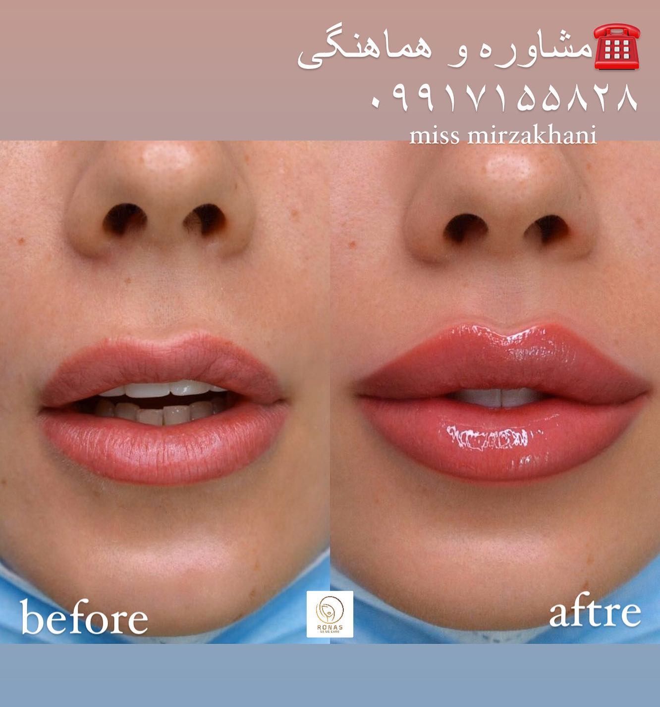 کلینیک زیبایی و لاغری روناس